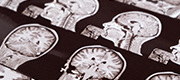 NeuroGlobal - Health Initiative